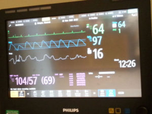 monitor vitals