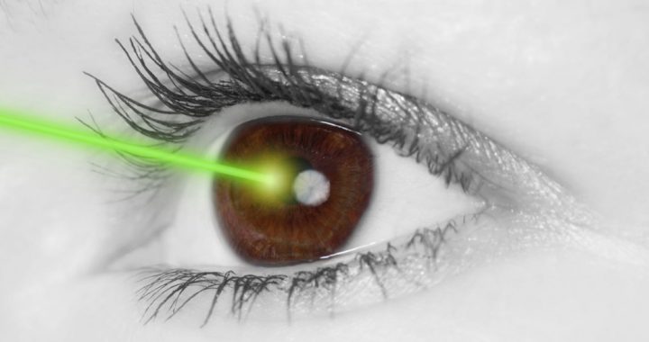 FREQUENTLY ASKED QUESTIONS ABOUT LASIK